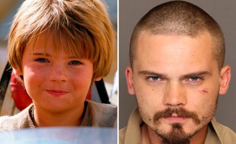 Jake Lloyd, Anakin Skywalker en ‘Star Wars’, internado en un centro de rehabilitación tras brote psicótico
